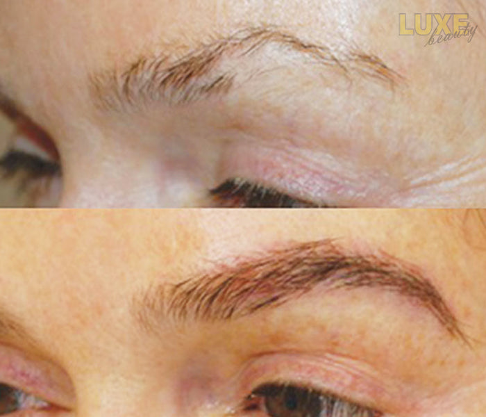 LUXE BEAUTY BROWS™ Innovative Anti-Aging Eyebrow Formula For Men and Women