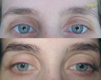 Thumbnail for LUXE BEAUTY BROWS™ Innovative Anti-Aging Eyebrow Formula For Men and Women